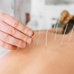 5-Addiction-Problems-Acupuncture-Can-Help-Treat-scaled