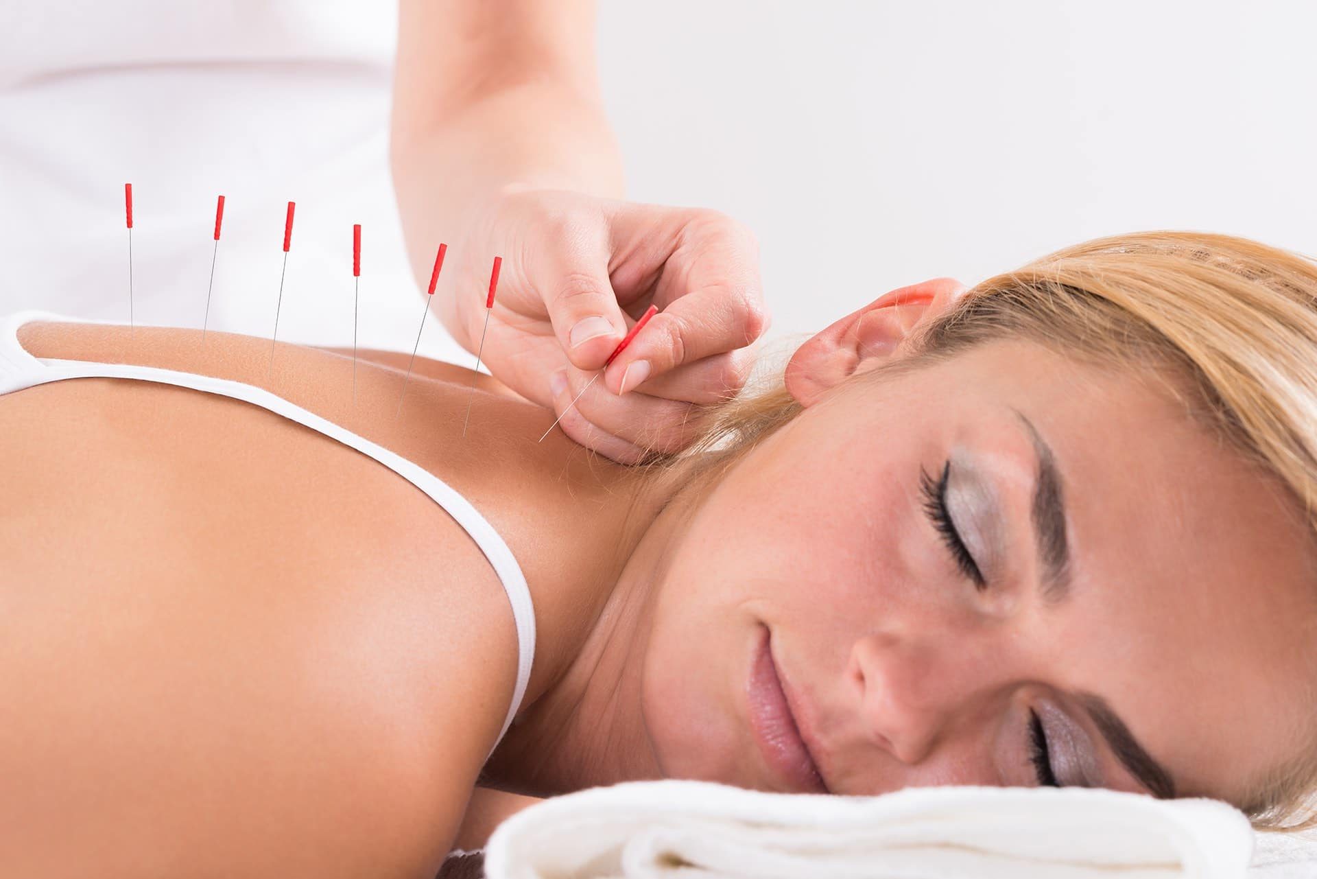 Tucson-Acupuncture-Clinic-www.oldpuebloacupuncture.com_-e1596926292155